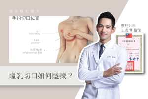 王醫師觀點_04_隆乳切口如何隱藏