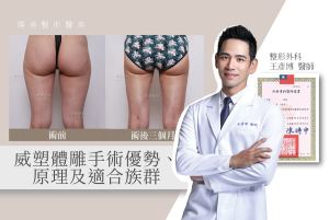 王醫師觀點_06_威塑體雕手術優勢