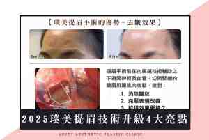 Cover_2025 Latest Arsty Clinic Eyebrow Lifting Technology Lazy Person's Guide - Scaled - 1