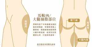 馬鞍肉大腿抽脂部位說明_璞美抽脂