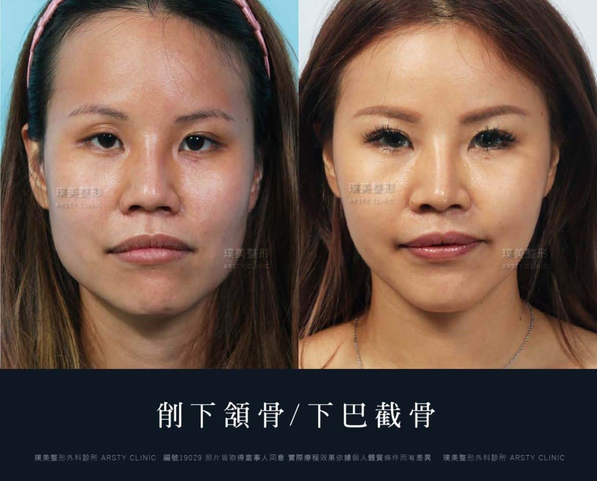 案例見證