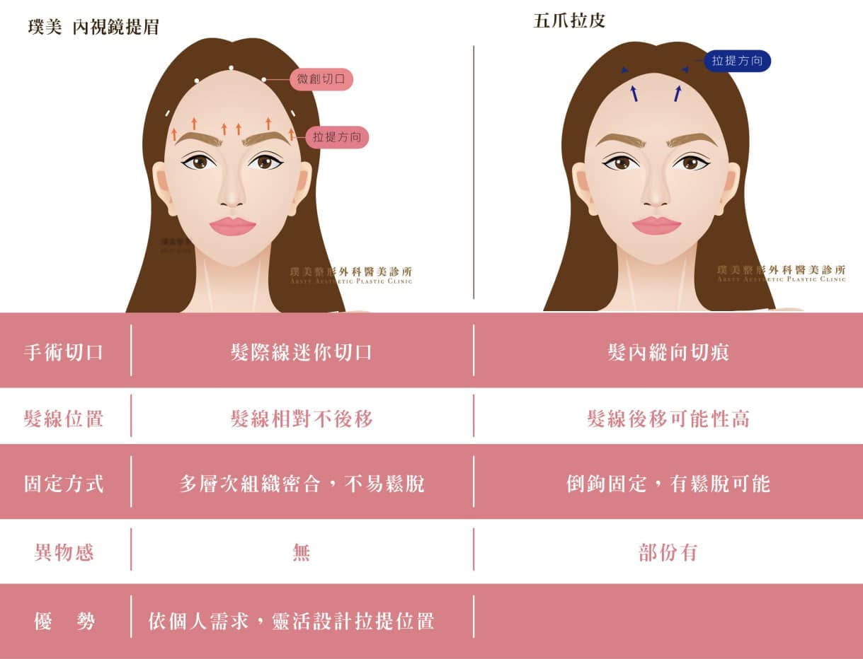 内視鏡下眉リフトと従来のフェイスリフトの違いは何ですか？