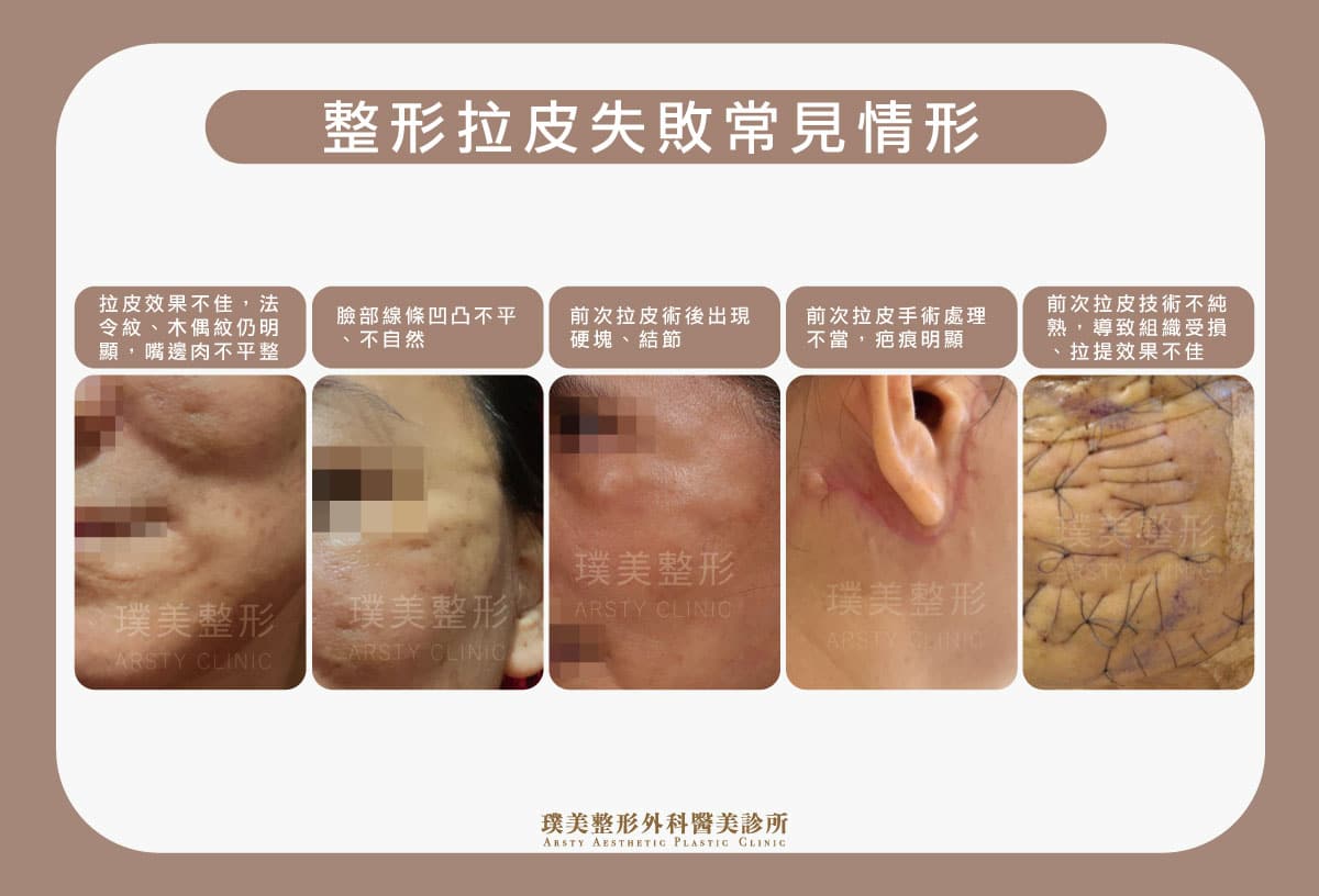なぜ私の顔は綺麗になるどころか、たるみがひどくなるのでしょうか？