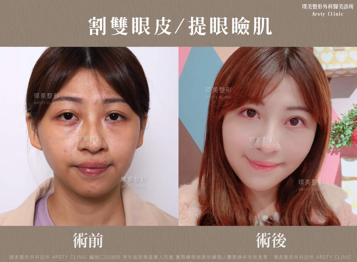 ▼擺脫瞳孔放大片制約，下垂無神眼進化電眼！▼