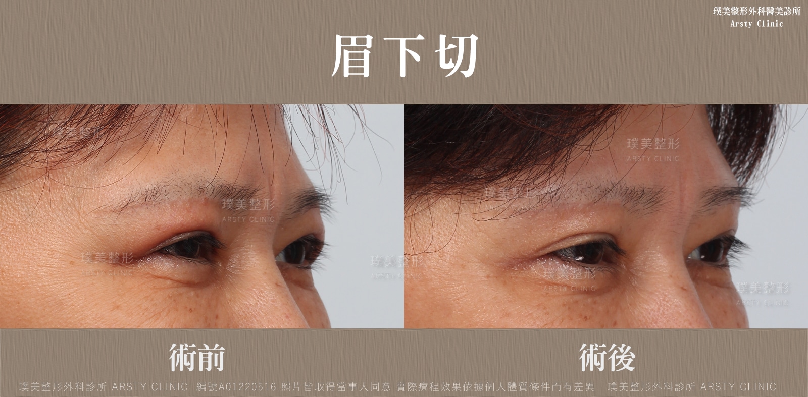 事例共有