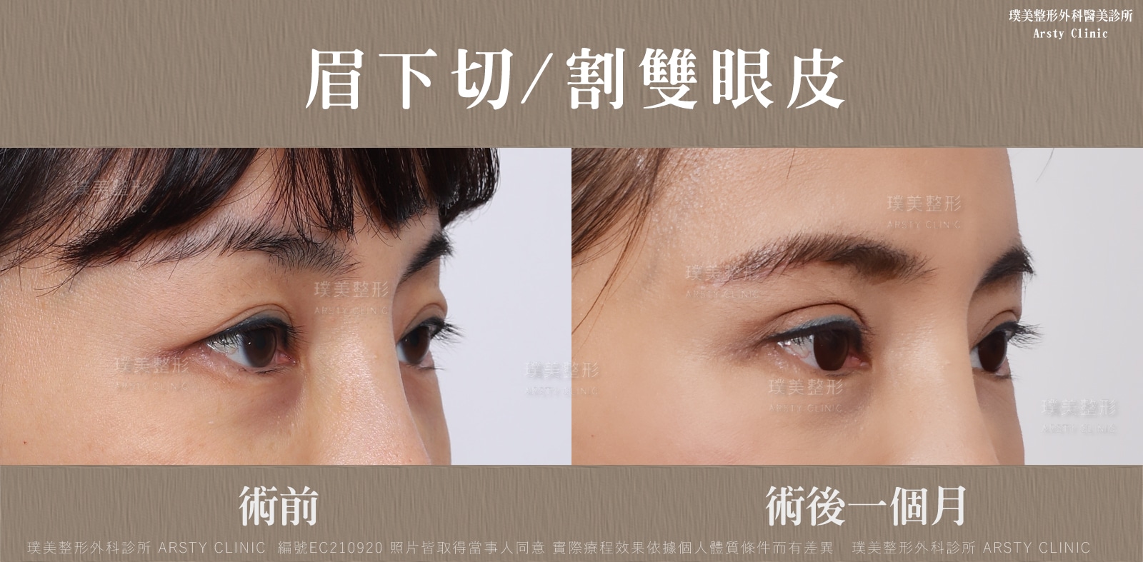 事例共有