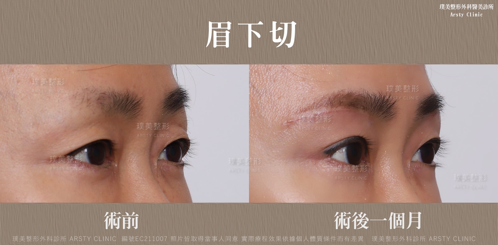 事例共有