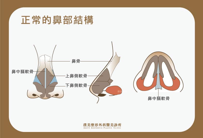 結構式隆鼻原理