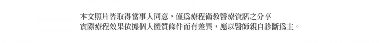 本院複合式眼袋手術優勢