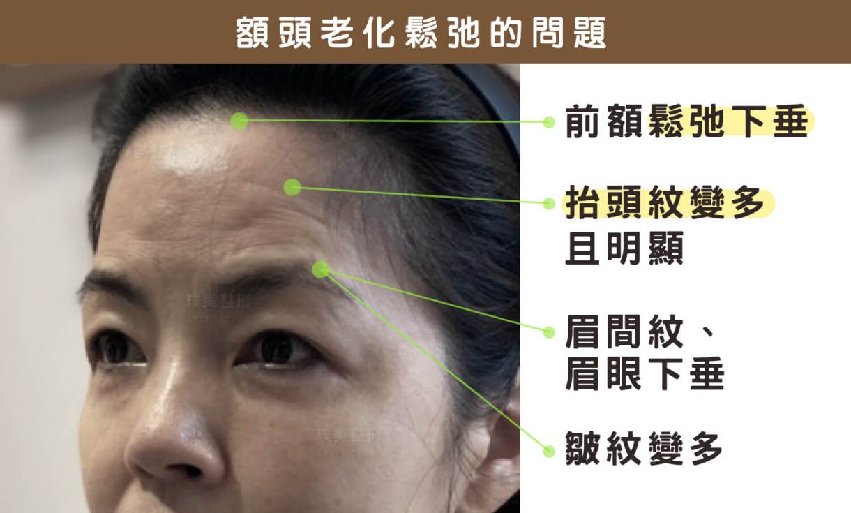 ハリがあり、ふっくらとしていて、バランスが良い――完璧な額に欠かせない3つの要素