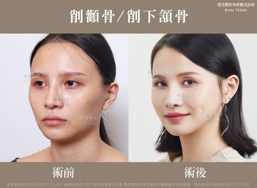 術後体験談