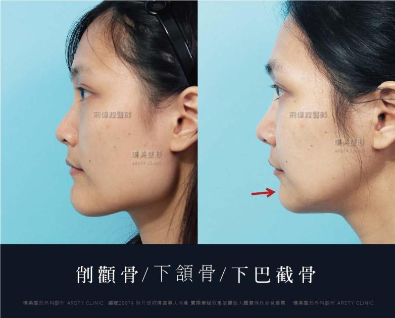 術後体験談