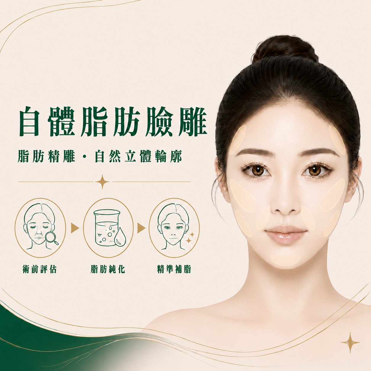 鼻 唇 溝
