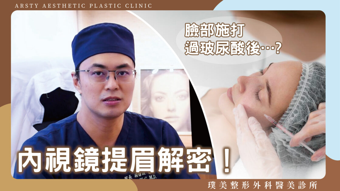 Youtube影片封面 43荊偉政醫師 注射玻尿酸後還可以做內視鏡提眉嗎？