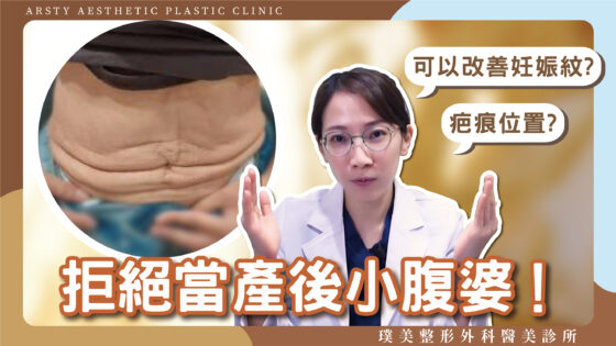 Youtube影片封面 陳心瑜醫師 06腹部拉皮產後修復