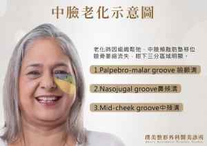 顔の中央部の老化図 - プーメイ - 王延波博士