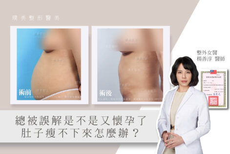 楊善淳醫師觀點 09產後肚皮瘦不下來怎麼辦