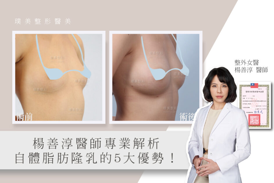 打造豐滿又自然的理想美胸，楊善淳醫師專業解析自體脂肪隆乳的5大優勢！